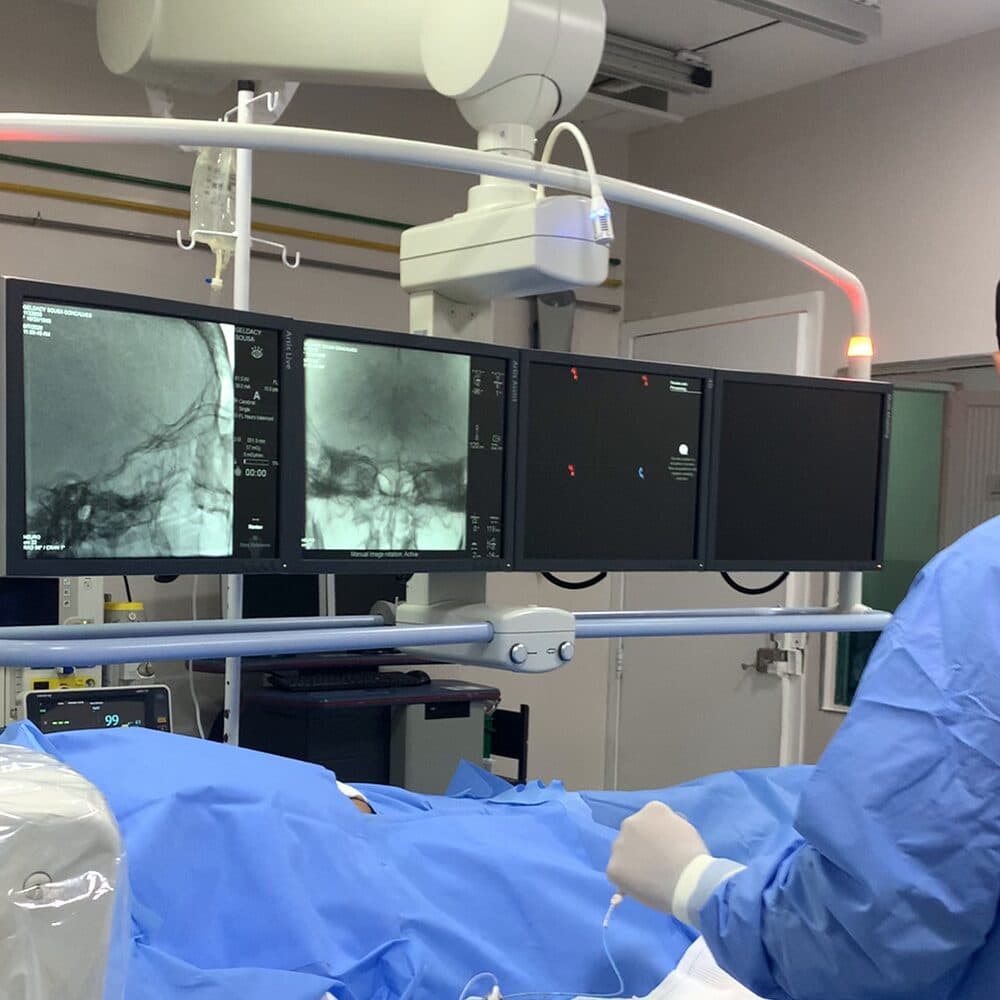 Neurointervenção